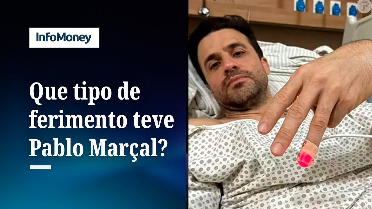 Pablo Marçal está internado com suspeita de fratura