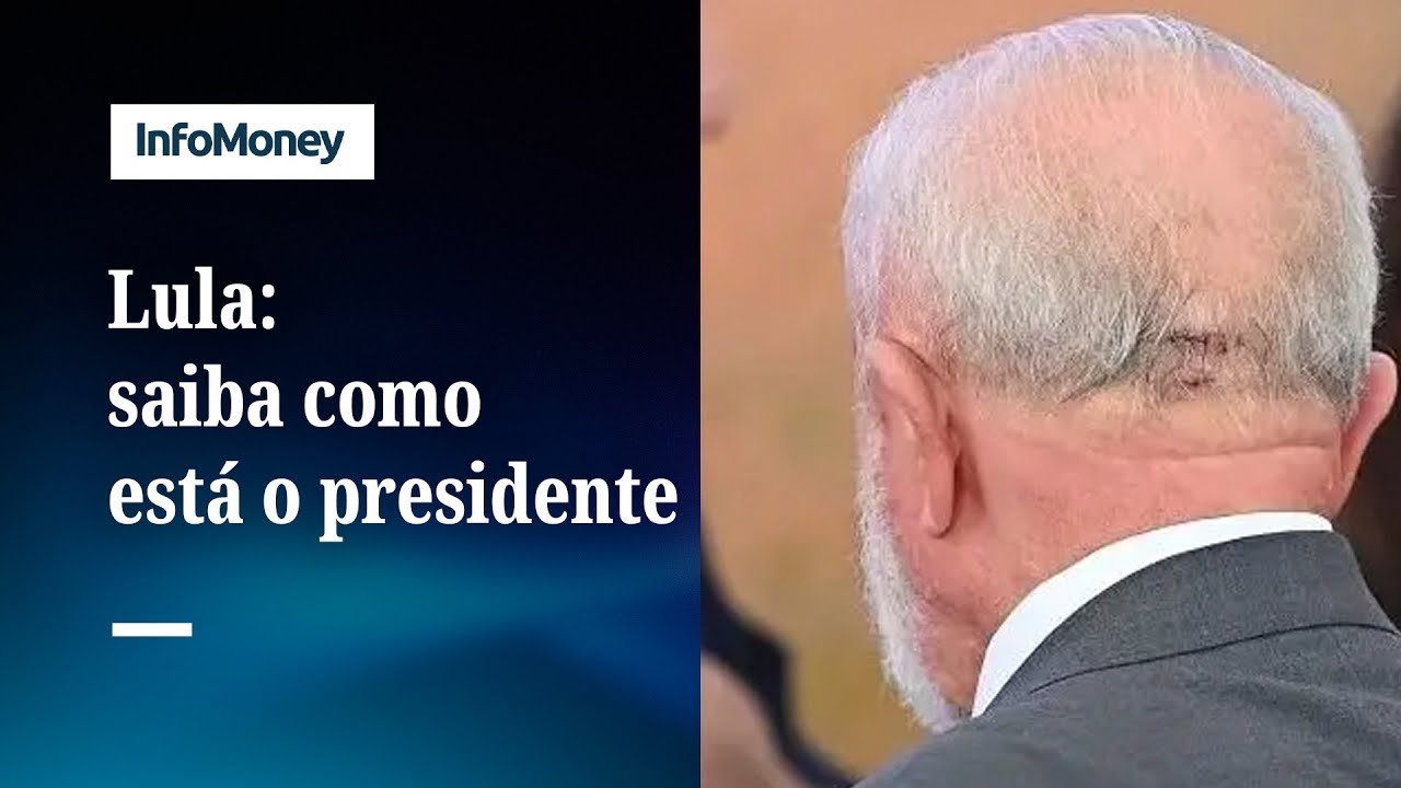 Lula está lúcido, orientado e evolui bem, diz novo boletim