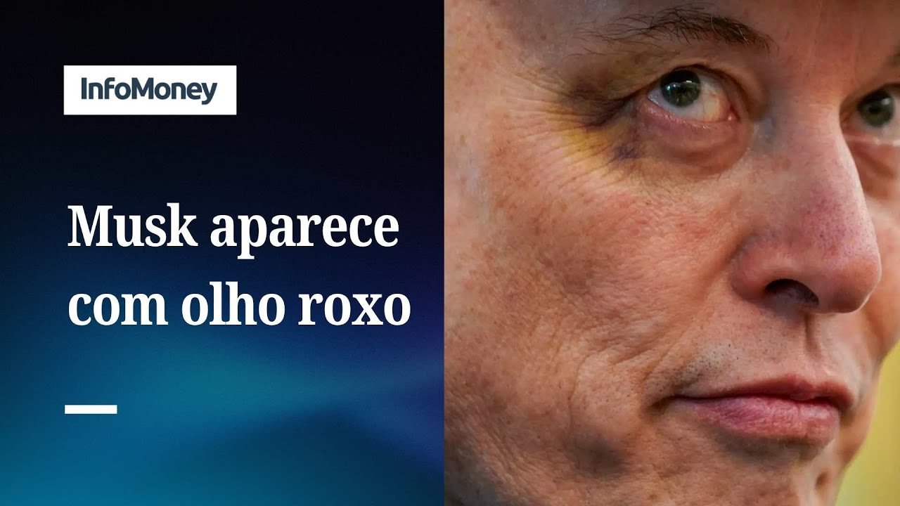 Elon Musk explica olho roxo