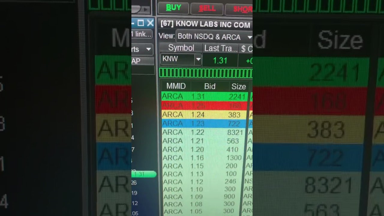 [LIVE] DAY TRADE – HOW TO PLAN U TRADE : SHORT SQUEEZE A+ SETUP $KNW