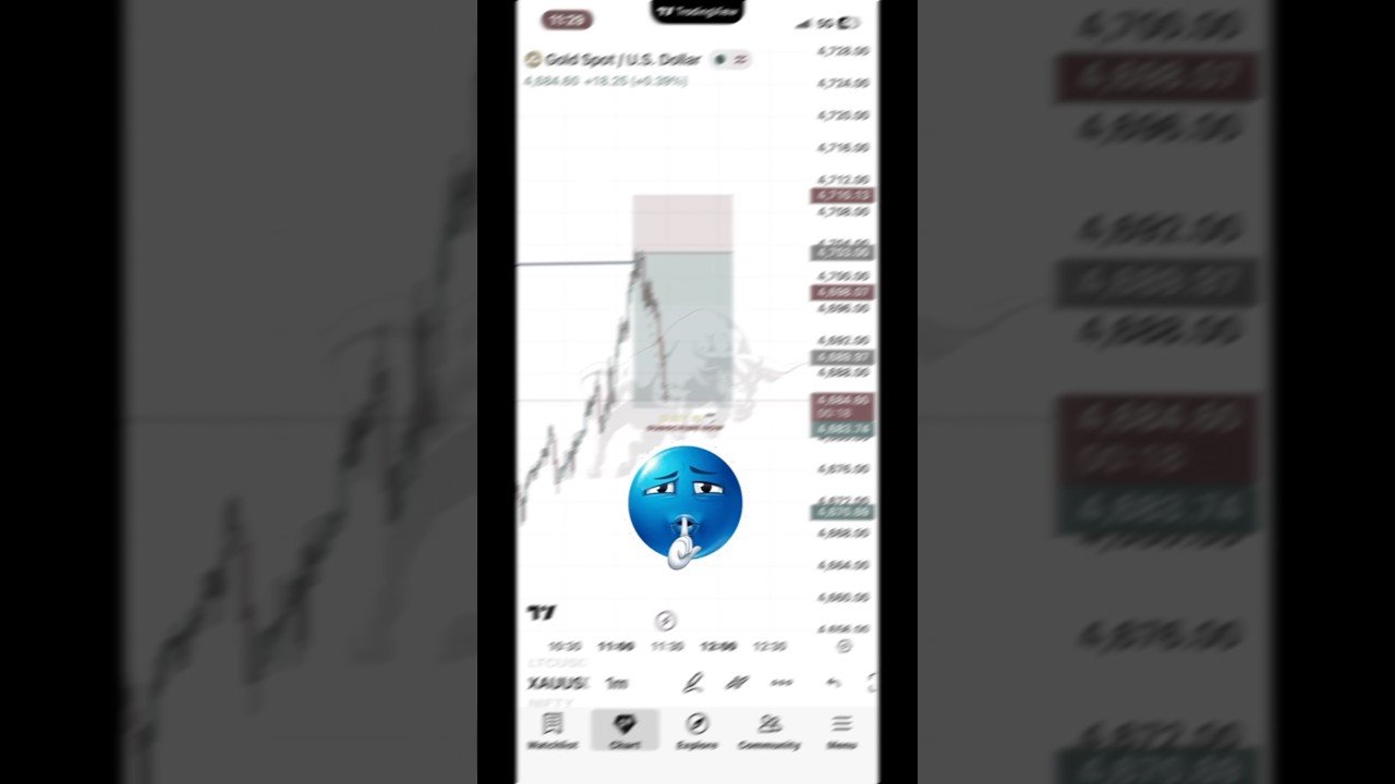 Day 5  gold live trade || #trading #shortvideo #stockmarket #forex #nifty #livetrading #daytrading