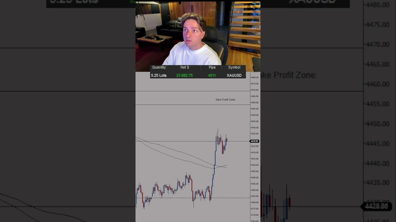 Who else does that?… #daytrading #daytrader #xauvictor #mentor
