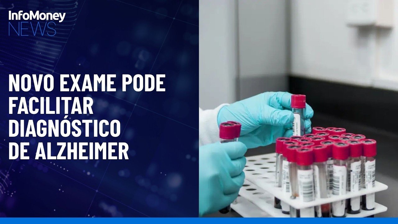 Novo exame de sangue pode simplificar diagnóstico de Alzheimer  | InfoMoney News